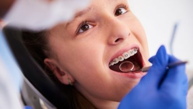 Orthodontic Treatment for Children: Early Intervention and Benefits