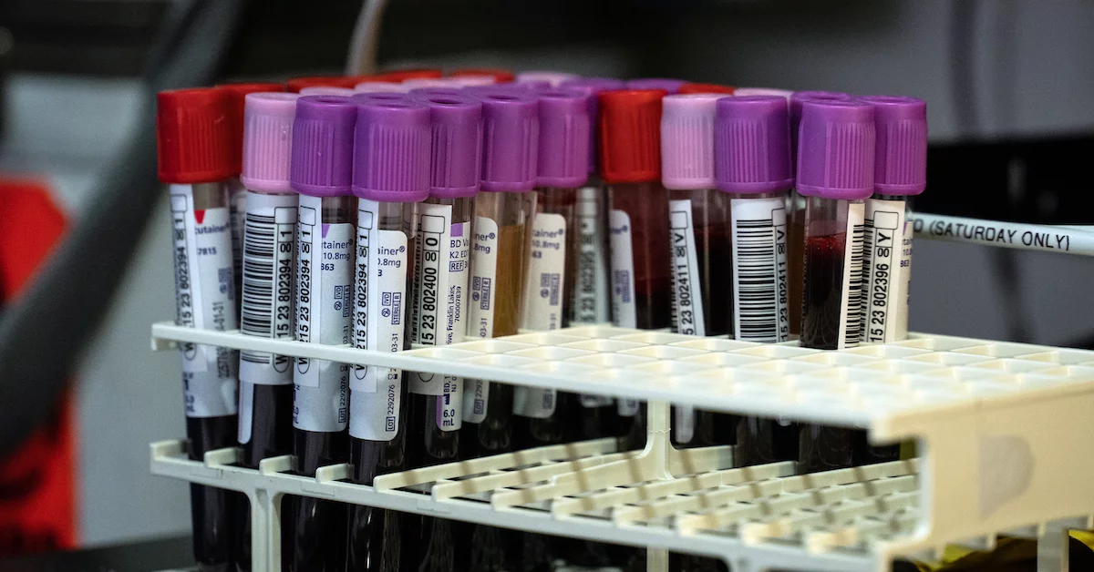 Unraveling the Mysteries of Blood: The Fascinating World of Hematology