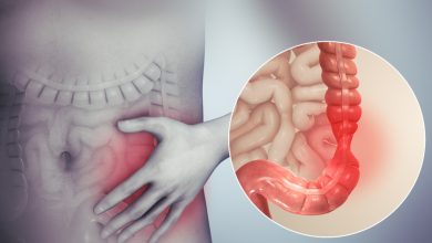 Causes of IBS and How to Manage It