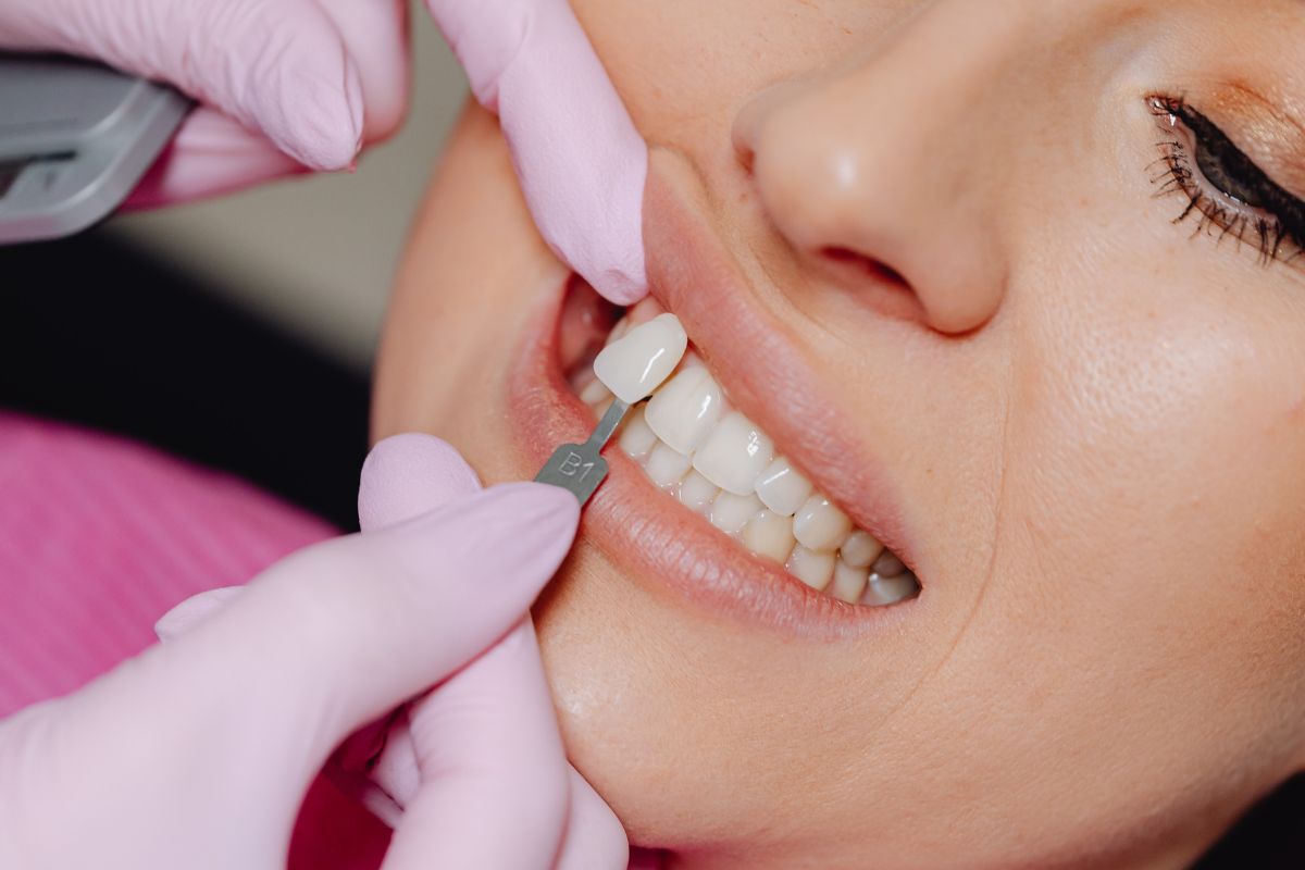 4 Signs It’s Time To Consider Cosmetic Dental Improvements