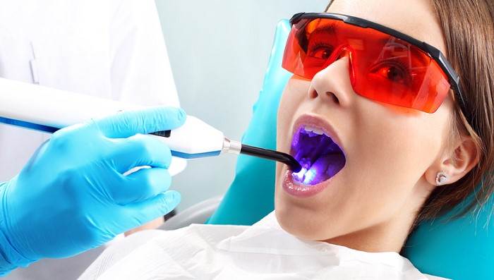 Integrating Photodynamic Therapy For Early Gum Disease Intervention