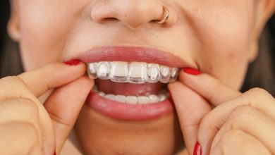 The Importance Of Consistency When Wearing Clearn Aligners