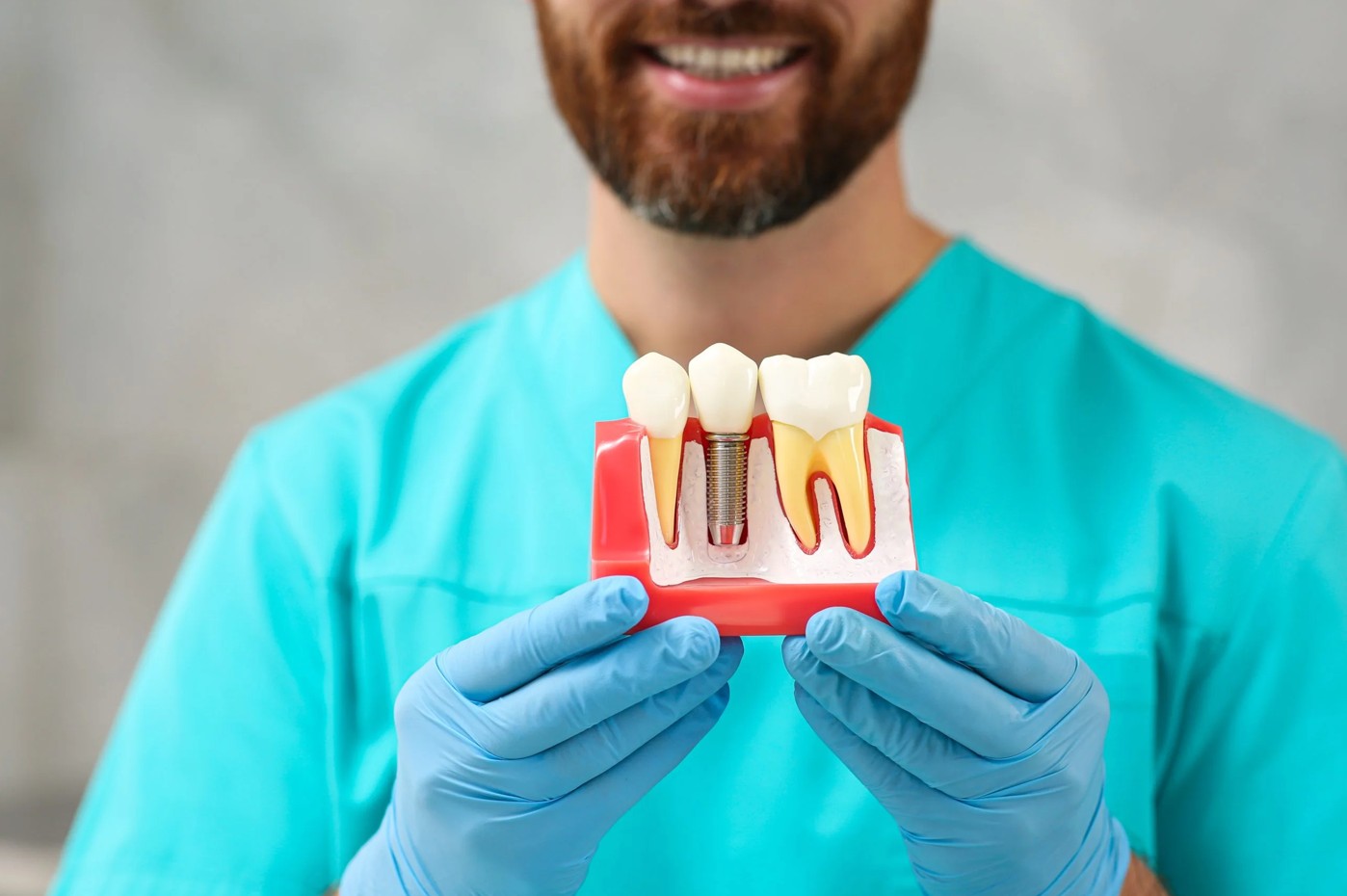 4 Types Of Dental Implants Patients Should Know About
