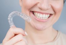 5 Signs Clear Aligners May Be Right For You