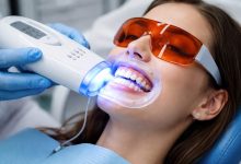 5 Small Smile Enhancements That Photograph Better Than Whitening Alone