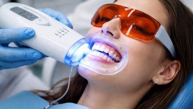 5 Small Smile Enhancements That Photograph Better Than Whitening Alone