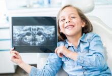 Dental X Rays For Children: Safety, Frequency, And What They Show