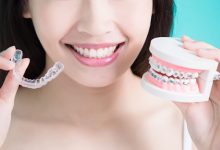 4 Key Differences Between Clear Aligners And Traditional Braces