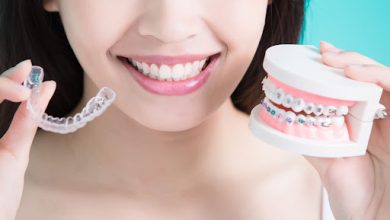 4 Key Differences Between Clear Aligners And Traditional Braces