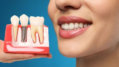 5 Benefits Of Dental Implants In Restorative Dentistry