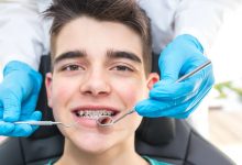 The Importance Of Preventive Care In Reducing Orthodontic Risks