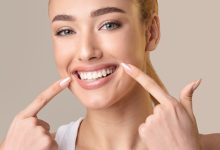5 Questions To Ask Before Booking A Smile And Skin Makeover