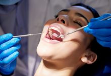 4 Questions To Ask Before Combining Teeth Whitening With Routine Cleanings