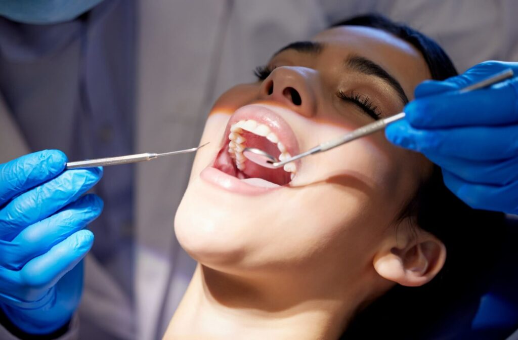 4 Questions To Ask Before Combining Teeth Whitening With Routine Cleanings