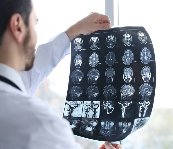 Understanding Brain Injuries After Serious Accidents and Their Lasting Effects