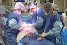 Why Consulting a Thoracic Surgeon Can Be Life-Changing What Patients Need to Know