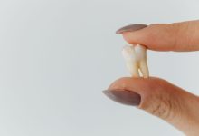 stuck baby tooth